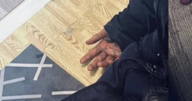 Қонаевта оқушылар сыныптасын соққыға жығып, жансақтау бөліміне түсірген