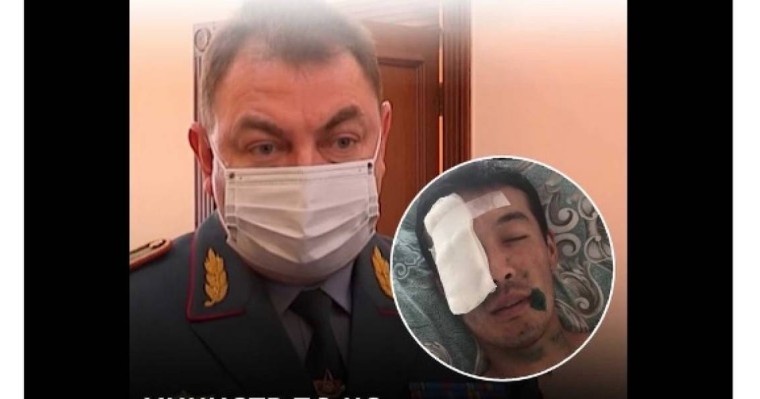 Жаралы өрт сөндірушінің сөзі шындық емес: Министрлік мәлімдеме жасады