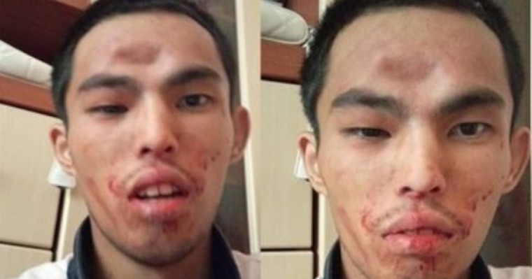 Алматыда әкесі баласын намаз оқымағаны үшін әбден ұрып, жансақтау бөлімінен бір-ақ шығарған