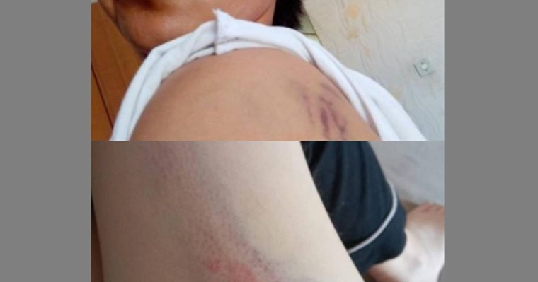 "Бәрі көк ала қойдай таяқ жеген": Белгілі заңгер елдегі қорғансыз әйелдерге араша түсті