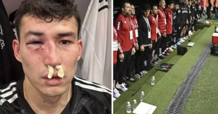 Қазақстандық футболшы Бақтияр Зайнутдинов ауыр жарақат алып, ауруханаға түсті