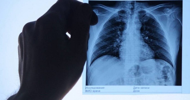 «Жаңа пневмония»: Бекшин адам өлімінің көп тіркелетінін айтты