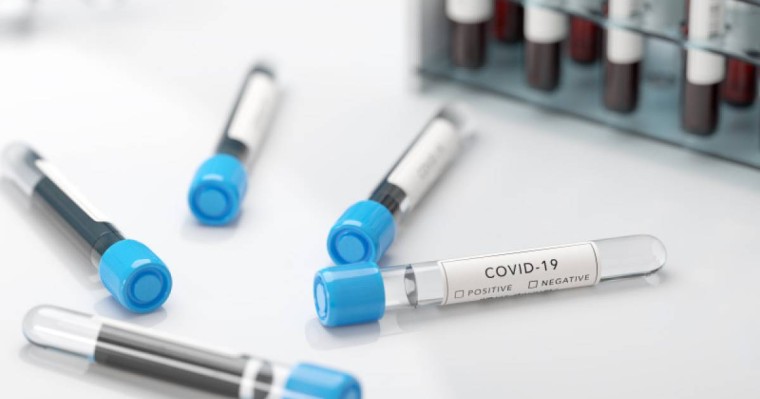 Вице-министр коронавирустың екінші толқыны туралы жаңа болжам айтты