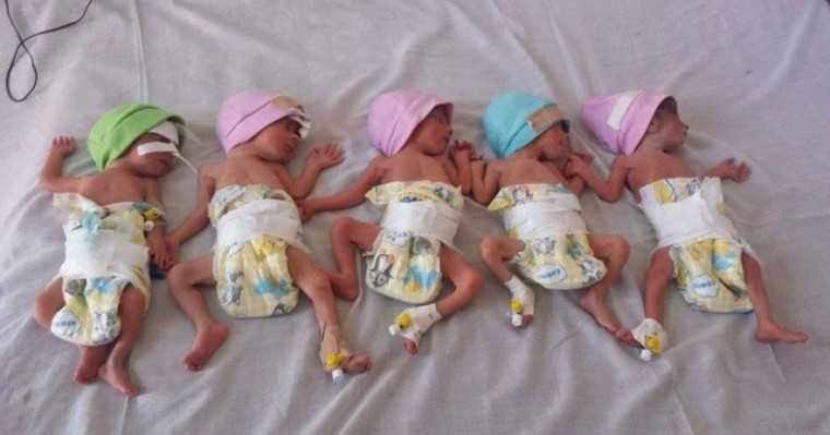 Үшінші перзентін күтіп жүрген әйел бірден 5 бала туды