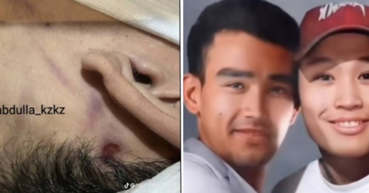 "Денесінде іздер бар": Адвокат Шерзаттың ағасының өліміне қатысты тың деректермен бөлісті