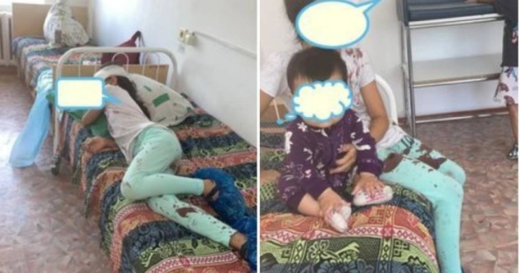 Алакөлде ер адам демалушыларға шабуылдаған: 8 жастағы қыз зардап шекті