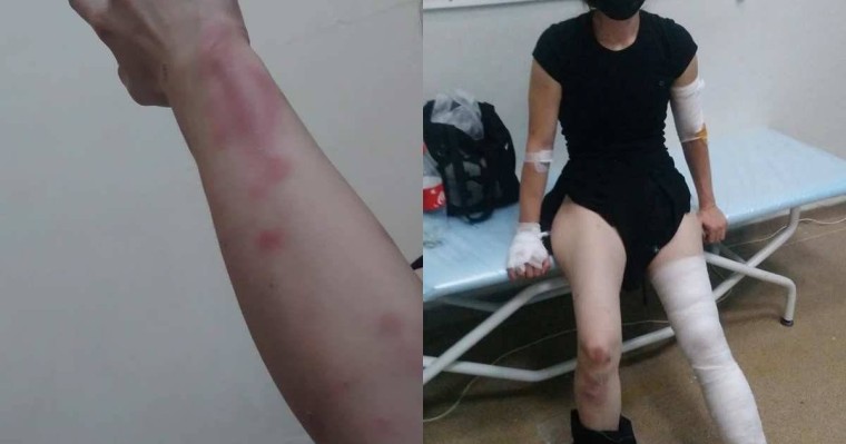 "Аяқ-қолымды сындырды": Алматылық әйел полицейлерден жәбір көргенін айтты