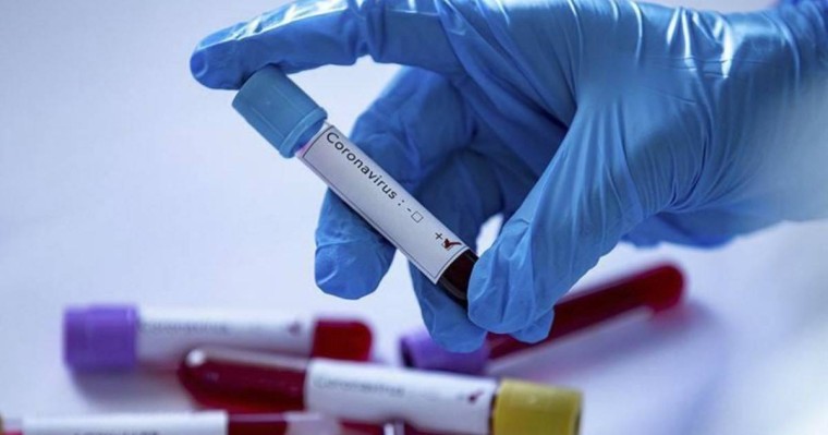 Қазақстанда бір тәулікте 2 мыңға жуық адам коронавирус жұқтырды