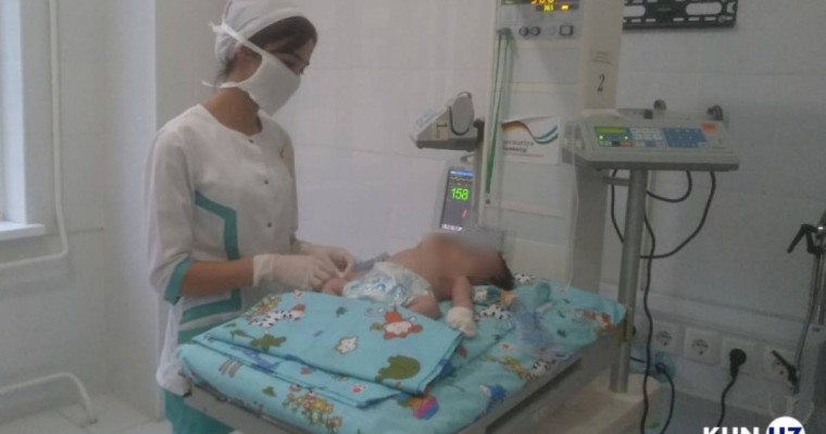 Өзбекстанда екі басы бар сәби туылды