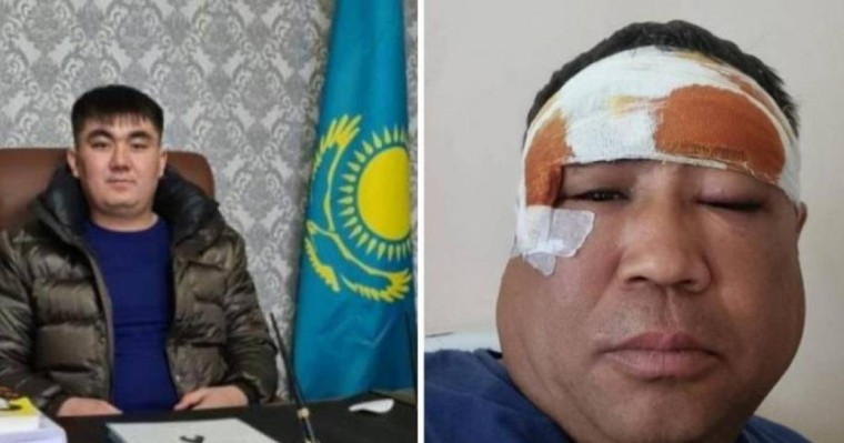 "AMANAT" партиясының депутаты фермерді соққыға жықты деп айыпталуда