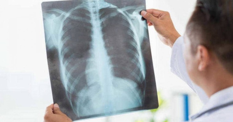 Нұр-Сұлтанда пневмониямен ауыратын 25 жастағы қыз қайтыс болды