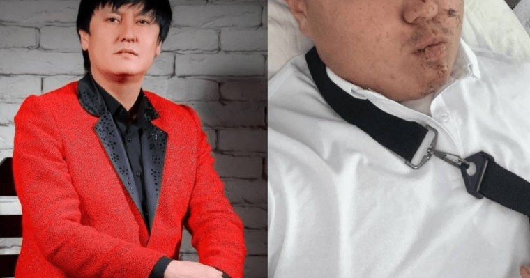 Өмірқұл Айниязовтың ұлы той алдында жол апатына түсті