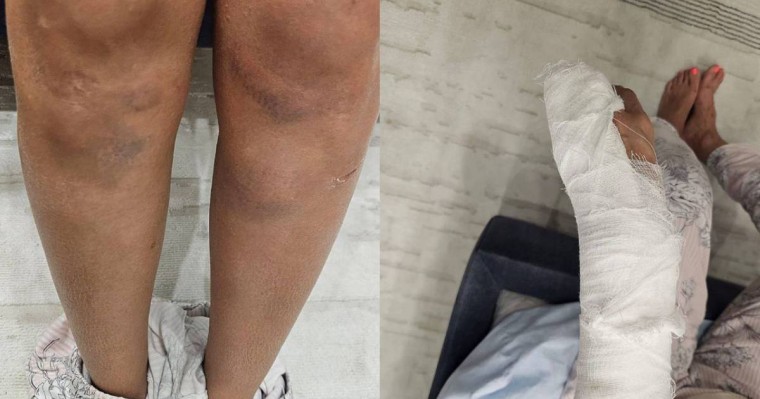 Алматы тұрғыны танымал қазақстандық спортшының соққыға жыққанын мәлімдеді