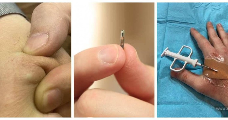 Чип салдырған бірінші қырғызстандық атанған жігіт тәжірибесімен бөлісті