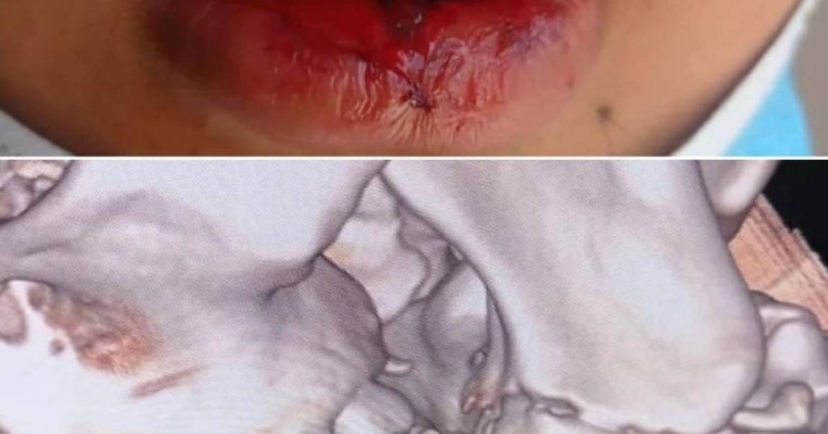 Атырауда 11-сынып оқушылары мектеп дәретханасында 10-сынып оқушысын соққыға жыққан