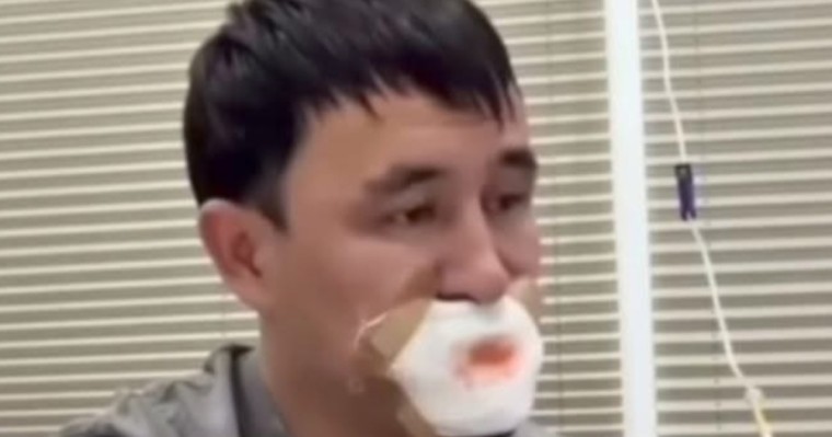 Сүйісіп, тілінен айырылған жігіт туралы тың ақпарат шықты