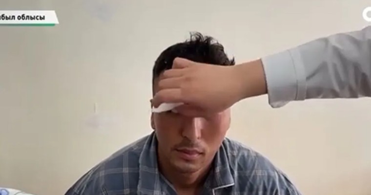 “Шоу жасады”: Басын бөтелкемен ұрып, көзінен айырылған сарбаздың анасы бар былықты әшкереледі