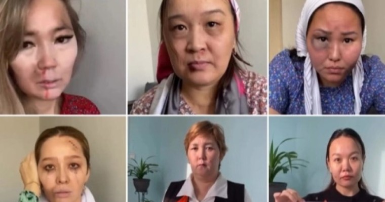 "Бет-аузы көгерген": Маңғыстаулық мұғалімдер зорлық-зомбылыққа қарсы шыққан видеосы тарады