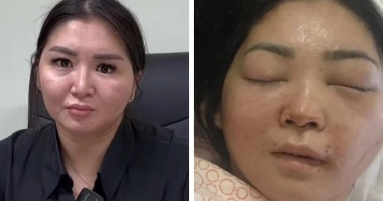 Күйеуі сабап, мүгедек болып қалған әйел сотталушының қоныс-колонияға ауыстырылғанына қарсы