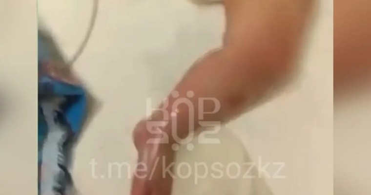 Астанада ауруханада 9 айлық сәби күйіп қалған