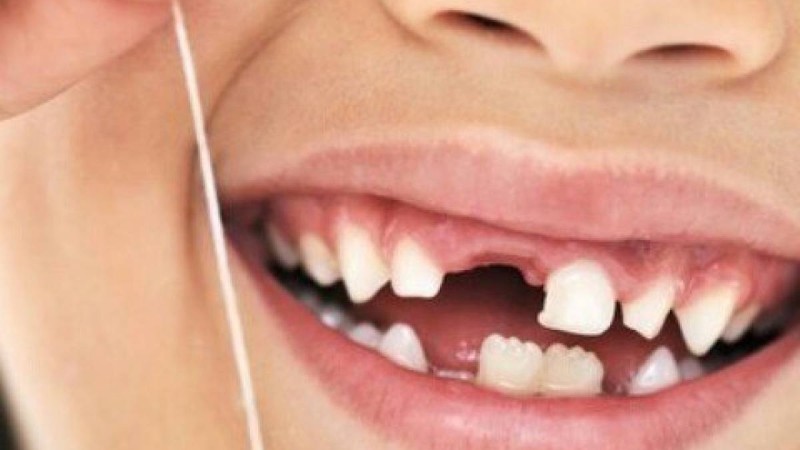 Сәбидің тісі тез шығу үшін