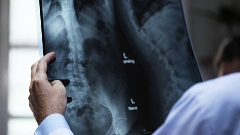 Ғалымдар бел мен мойынның ауыруы қауіпті аурудың белгісі екенін айтты