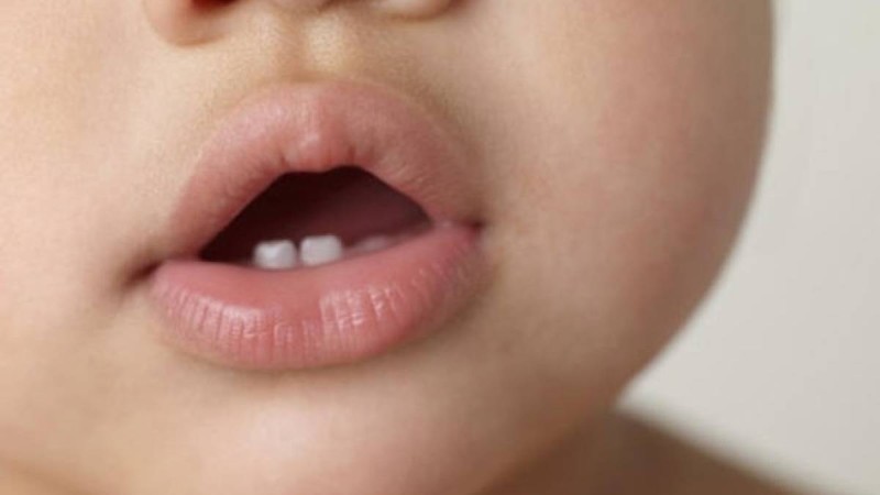 БАЛАНЫЗҒА ТІС ШЫҒА БАСТАДЫМА