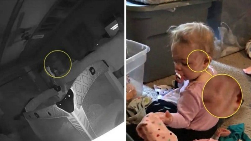 Қызының бетін кім тырнағанын білу үшін камерадағы жазбаны көрген ата-анасының зәре-құты қалмады (видео) - Қазақстан жаңалықтары