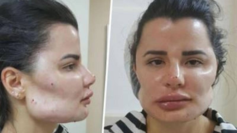 Адамдардың түрін құбыжыққа айналдырған хирургті сотқа берді