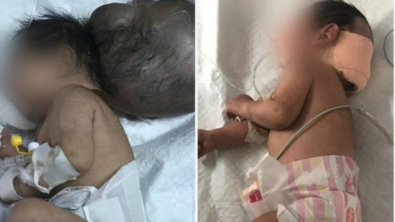 Әкесі жаңа туған сәбиін көргеннен кейін оны тірідей көміп тастаған - Қазақстан жаңалықтары