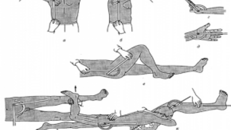 Буын қозғалғыштығын анықтау | KazMedic