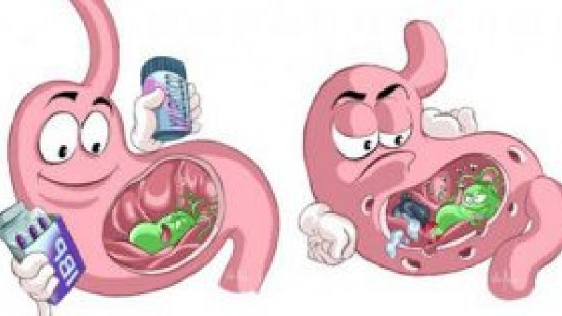 Созылмалы гастрит | KazMedic