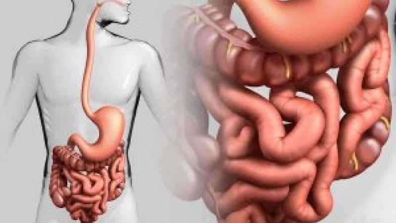 Тітіркенген ішек синдромы