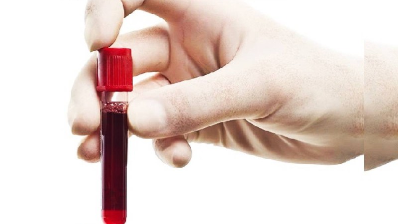 Түс жору: Түсінде қан көру. Қан түске кірсе ол нені білдіреді? • Түс Жору