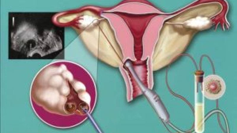 Инвазивті зерттеу әдістері