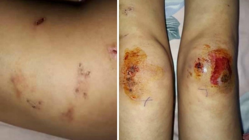 Денесіне пышақ тығып, ыстық пештің үстіне шығарған: Түркістан облысында өгей ана қыздарына жантүршігерлік әрекеттер жасаған - Қазақстан жаңалықтары