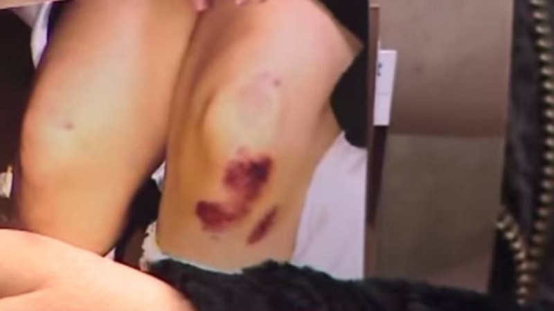 "Анам, әкем үшеумізді ұрып-соқты": Елордада бойжеткенді көлікпен сүйреп, мүгедек еткен әскери қызметкер әлі жазаланған жоқ - Қазақстан жаңалықтары