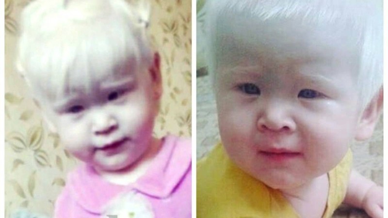 Оралда тұратын альбинос қыз жайлы не білеміз? (фото) - новости Казахстана