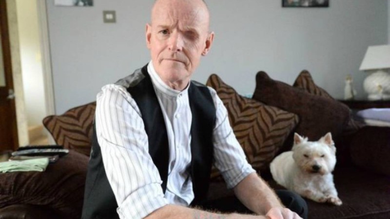 Мұрнындағы ісікті көріп, өзін жәндік шақты деп ойлаған ер адам көзінен айырылды - Қазақстан жаңалықтары