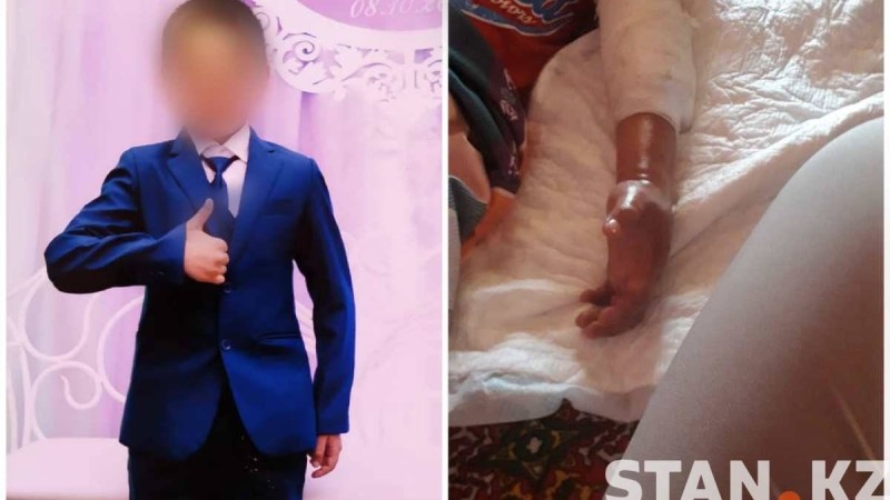 «Сынық қолмен жүре беретін едім»: Емшіге барған соң көз жұмған баланың соңғы сөзі  - Қазақстан жаңалықтары