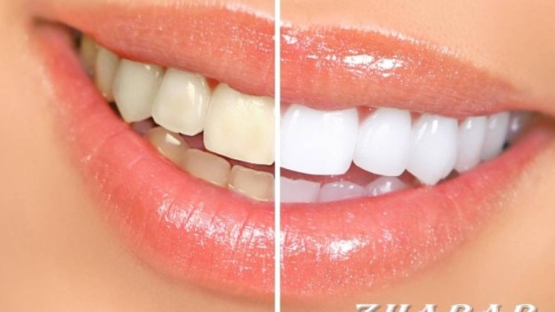 Тісті үйде ағарту жолдары