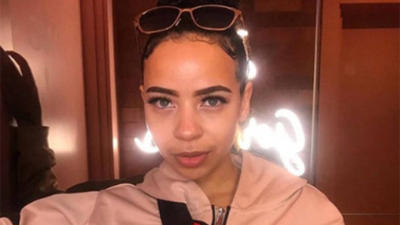 Еттен бас тартқан әйелдің шашы түсіп қалды - Қазақстан жаңалықтары