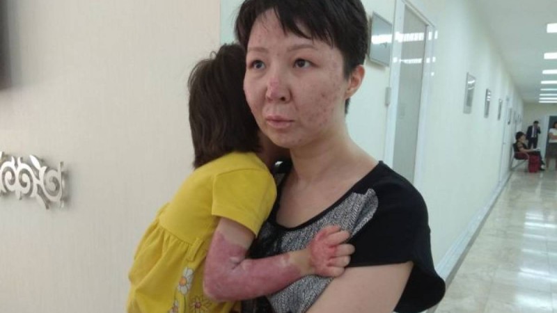 Ата-анасынан айырылып, мүгедек болып қалды: павлодарлық әйелдің жантүршігерлік оқиғасы