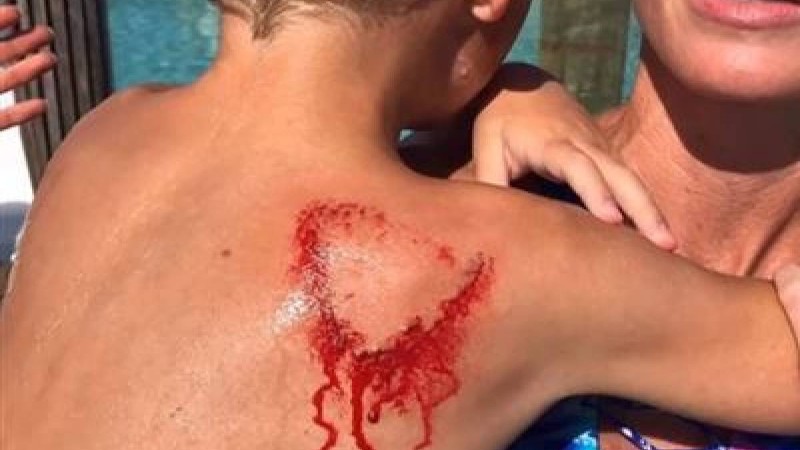 Әкесі ұлына жармасқан акуланы жұлып алды