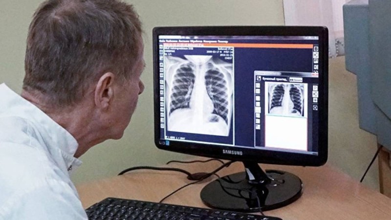Қазақстанда туберкулездің жаңа түрі таралып жатыр