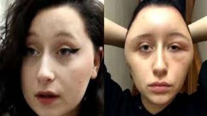 Шашын бояған бойжеткеннің беті ісіп кеткен