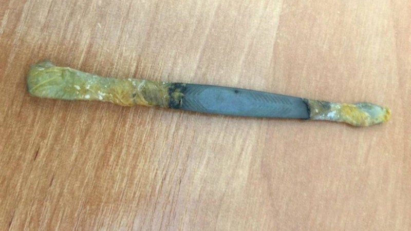 Маңғыстау облысында дәрігерлер түрмеде жазасын өтеп жатқан ер адамның асқазанынан скальпель алып шықты - Қазақстан жаңалықтары