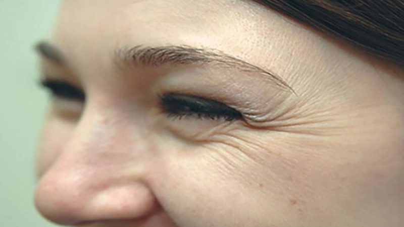 Әжімдер сіз туралы не айтады?