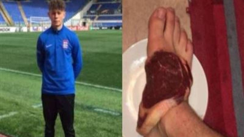 Футболшы командаласын шикі етпен емделуге мәжбүрлеген