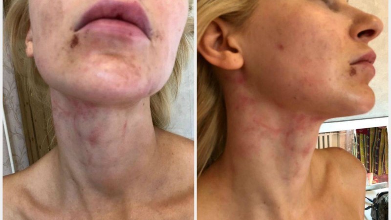 "Сөзінің растығы тексеріледі": ІІМ күйеуінен аяусыз таяқ жеген алматылық әйелдің ісін бақылауға алды
Іс дене жарақатын келтіру фактісі бойынша қарастырылуда